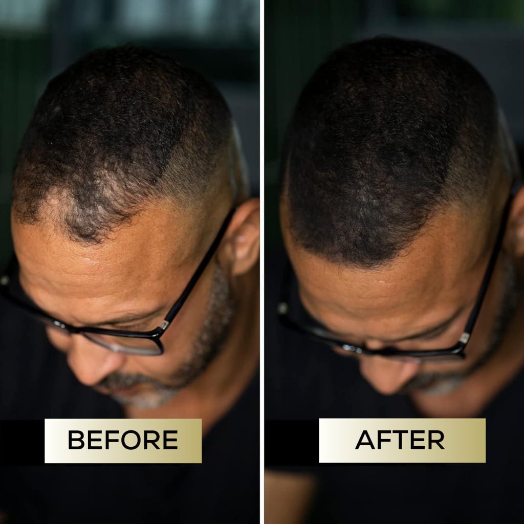 Ardene™ – Scalp Concealer for fuller looking hair - Lasts up to 7 days
