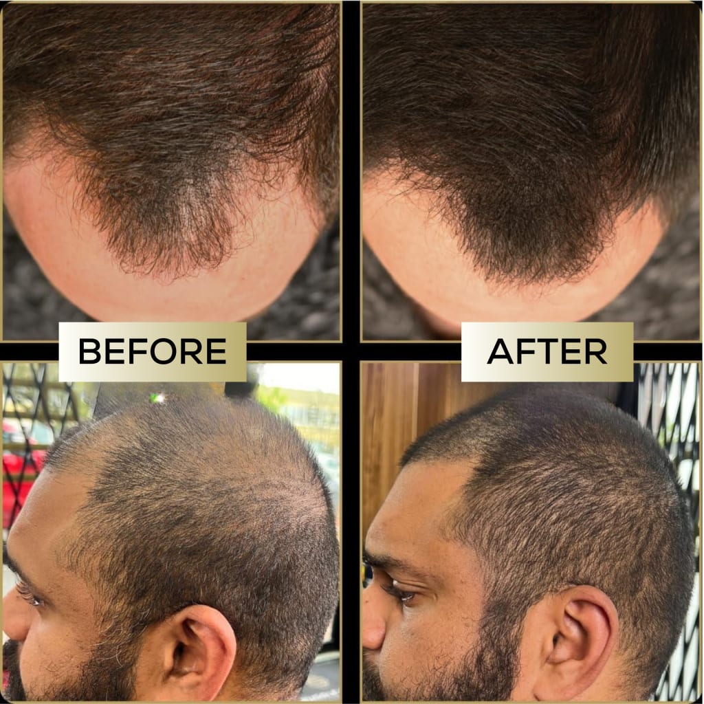 Ardene™ – Scalp Concealer for fuller looking hair - Lasts up to 7 days