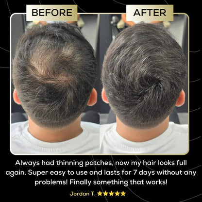 Ardene™ – Scalp Concealer for fuller looking hair - Lasts up to 7 days